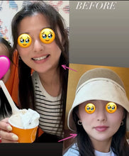 將圖片載入到圖庫檢視器中, Silvia LuxRF™ V-FaceLift and Tightening - 60min