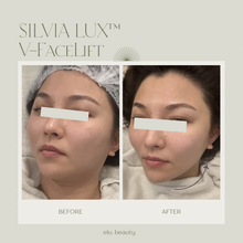 Load image into Gallery viewer, Silvia LuxRF™ V-FaceLift and Tightening - 60min