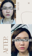 將圖片載入到圖庫檢視器中， Silvia LuxRF™ V-FaceLift and Tightening - 60min