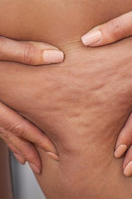 Load image into Gallery viewer, Silvia LuxRF™ Body Tightening &amp; Stretch marks